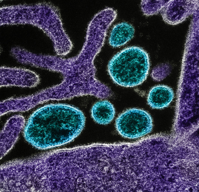 Blue and green virus particles viewed under a microscope with a black background