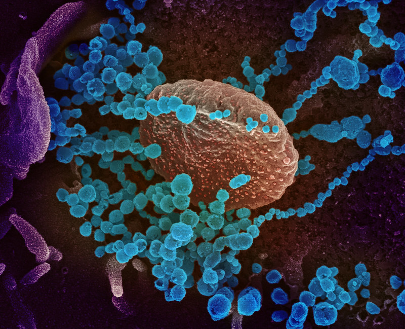 SARS-CoV-2 (round blue objects) emerging from the surface of cells