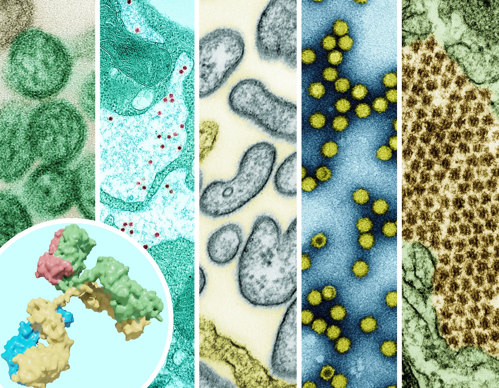 Colorized images of five different pathogens– hantavirus, yellow fever, Nipah virus, picoronavirus, and Chikungunya. A monoclonal antibody is shown in the foreground.