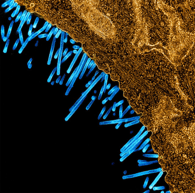 swine influenza virus particles attached to and budding off a cell