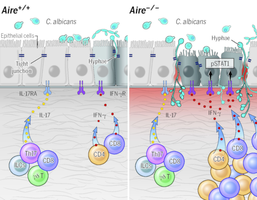 An illustration of healthy and AIRE deficient mucosal tissues