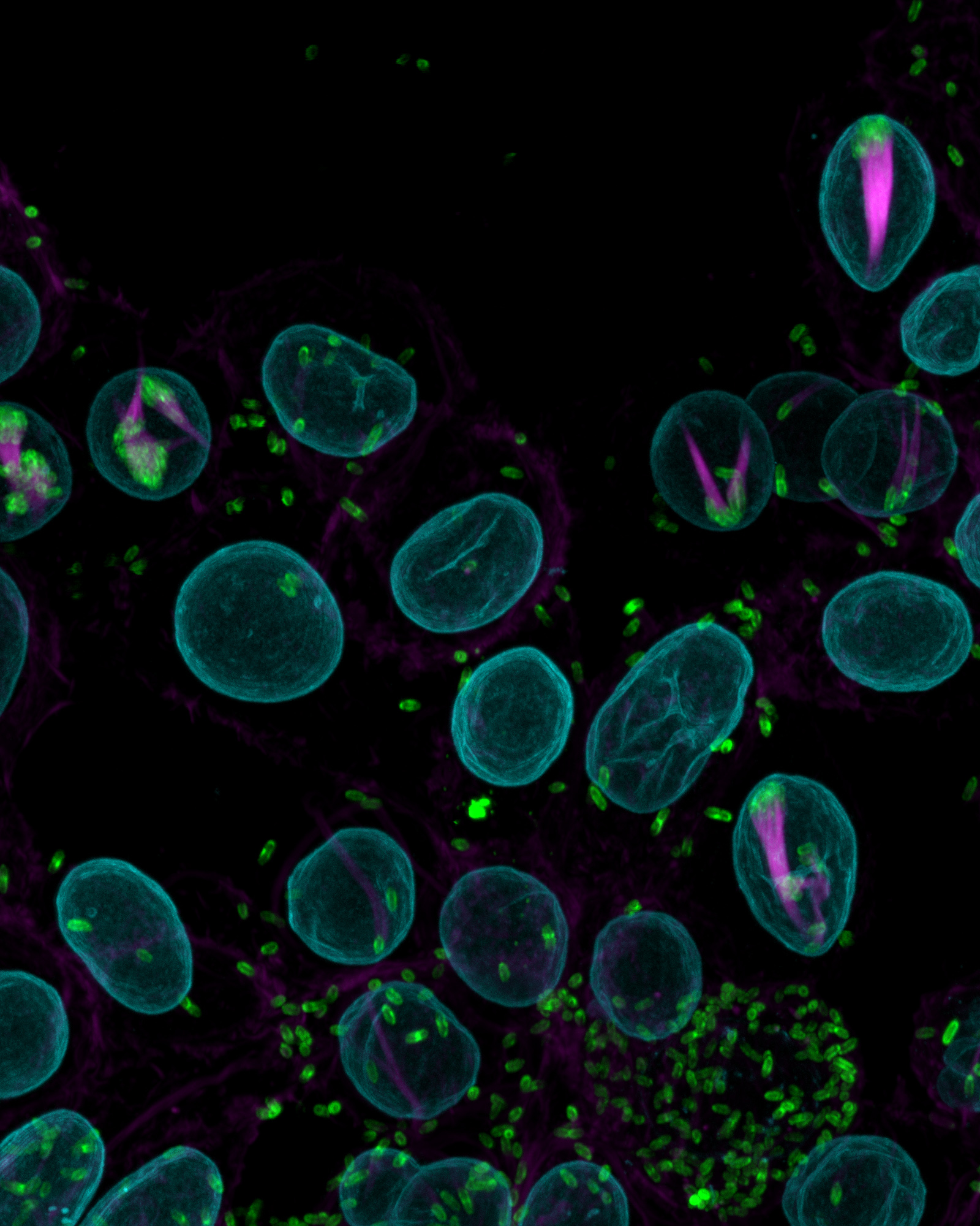  highly virulent Rickettsia rickettsii Sheila Smith (green) producing large actin tails (magenta)