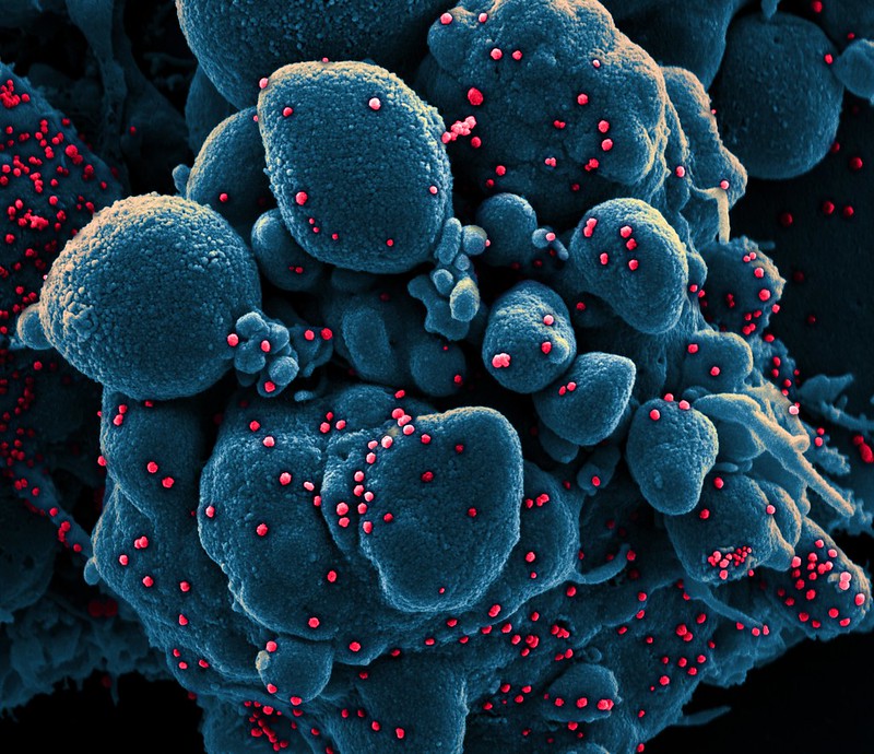 This image shows a colorized scanning electron micrograph of an apoptotic cell (blue) infected with SARS-COV-2 virus particles (red), isolated from a patient sample. The patient sample is not from the study described in this blog post. Image captured at the NIAID Integrated Research Facility in Fort Detrick, Maryland.