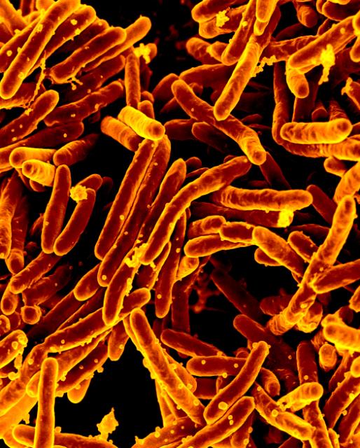 Mycobacterium tuberculosis bacteria, which cause tuberculosis