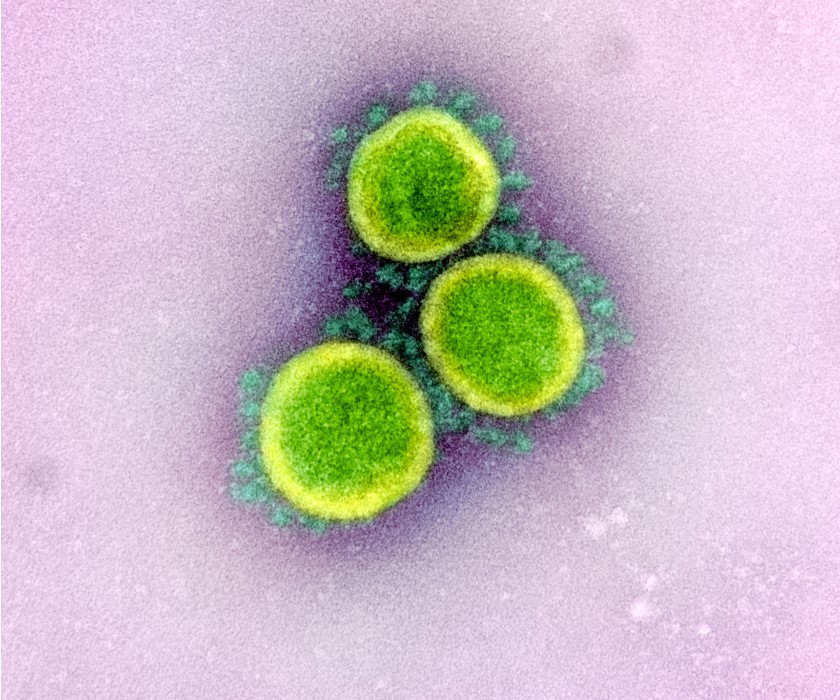 A transmission electron micrograph image of particles of SARS-CoV-2, the virus that causes COVID-19, isolated from a patient