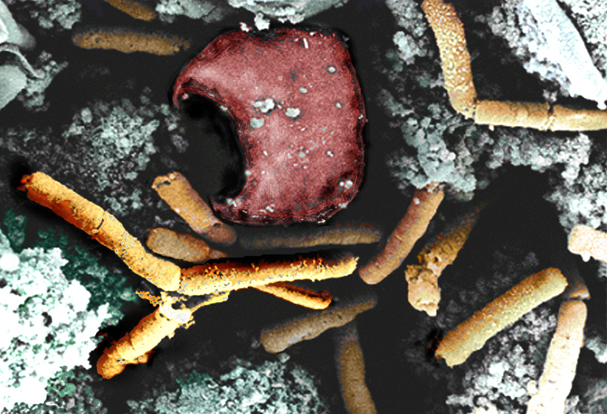 Rod-shaped bacilli (yellow) and an erythrocyte (red) shown in color-enhanced scanning electron micrograph of inhalational anthrax.