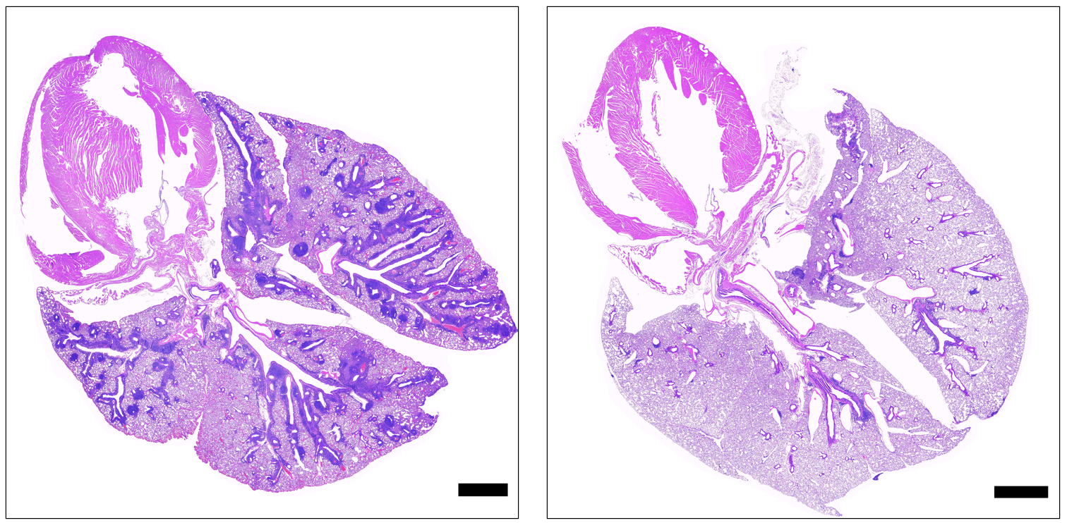 Two pink- and purple-speckled, lobe-shaped lung cross-sections in black-bordered boxes with white backgrounds, the left one with several dark purple regions in the cross-section.