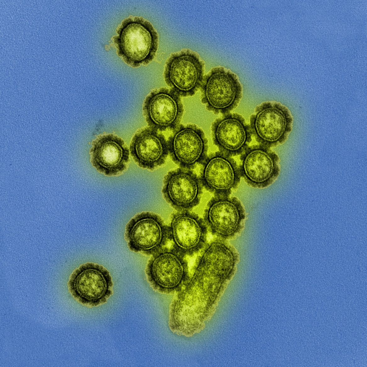 influenza virus particles, showing their round shape and bumpy surface proteins.