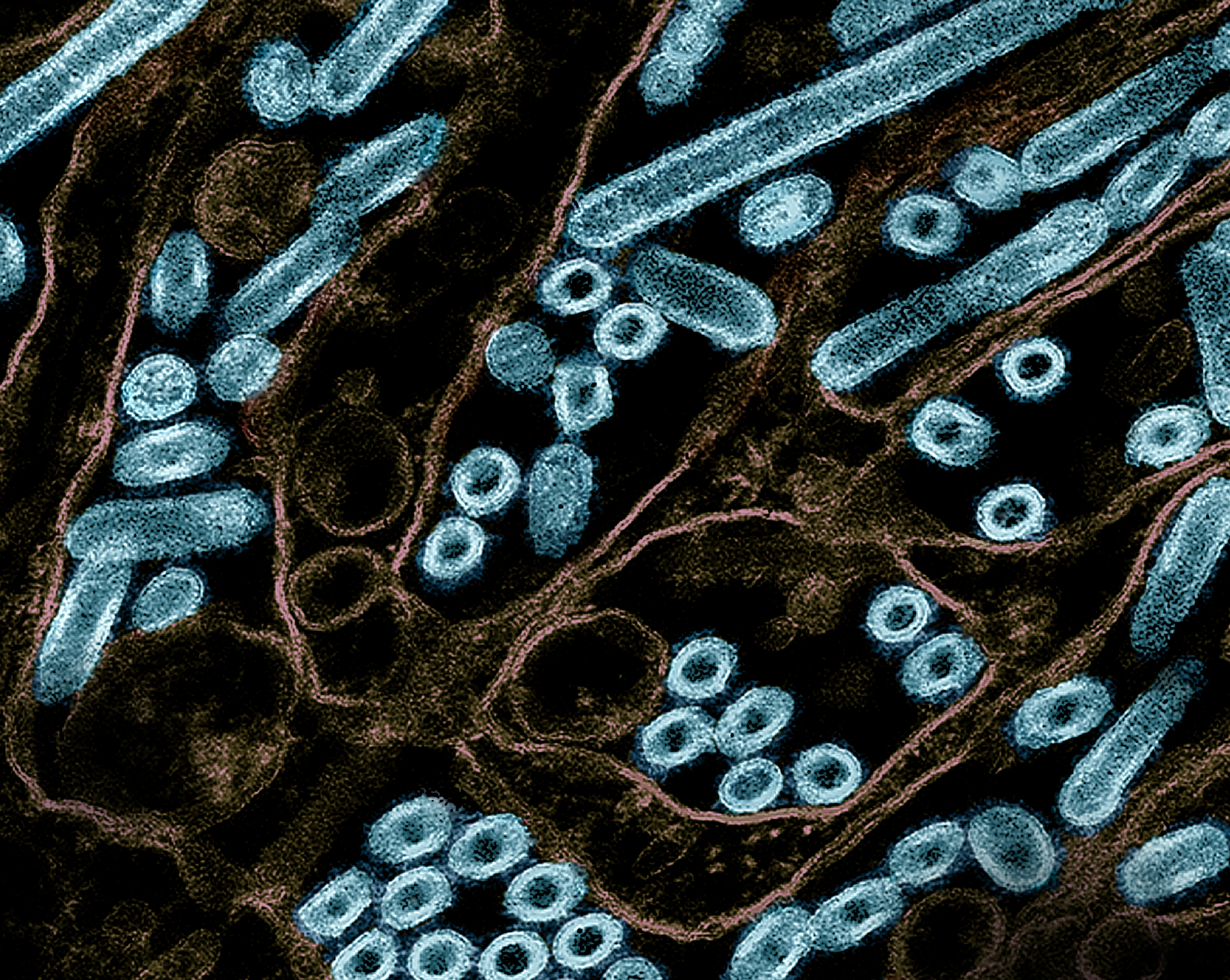 This transmission electron micrograph shows avian influenza A H5N1 virus particles grown in epithelial cells.