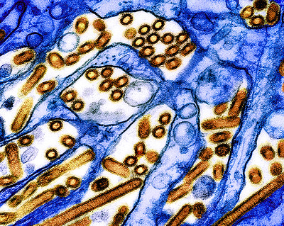 Yellow/red particles of avian influenza A H5N1 virus particles.