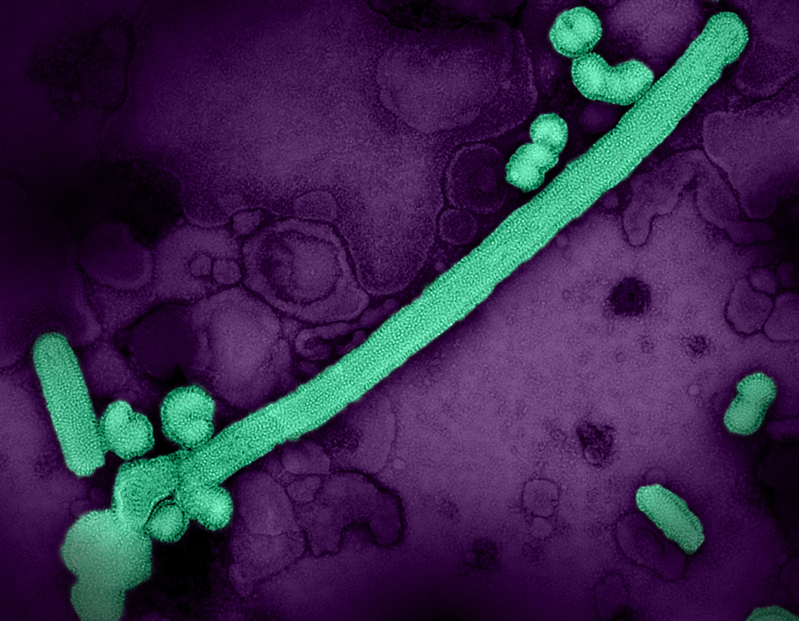 Teal influenza A virus particles—as filaments and spheres—on a purple background.