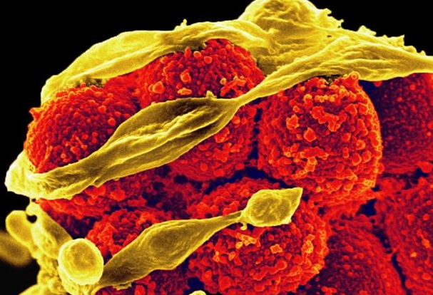 Colorized SEM of MRSA