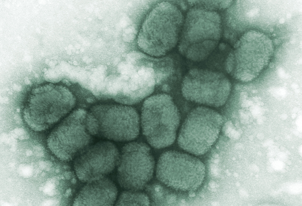 A transmission electron micrograph of smallpox viruses.