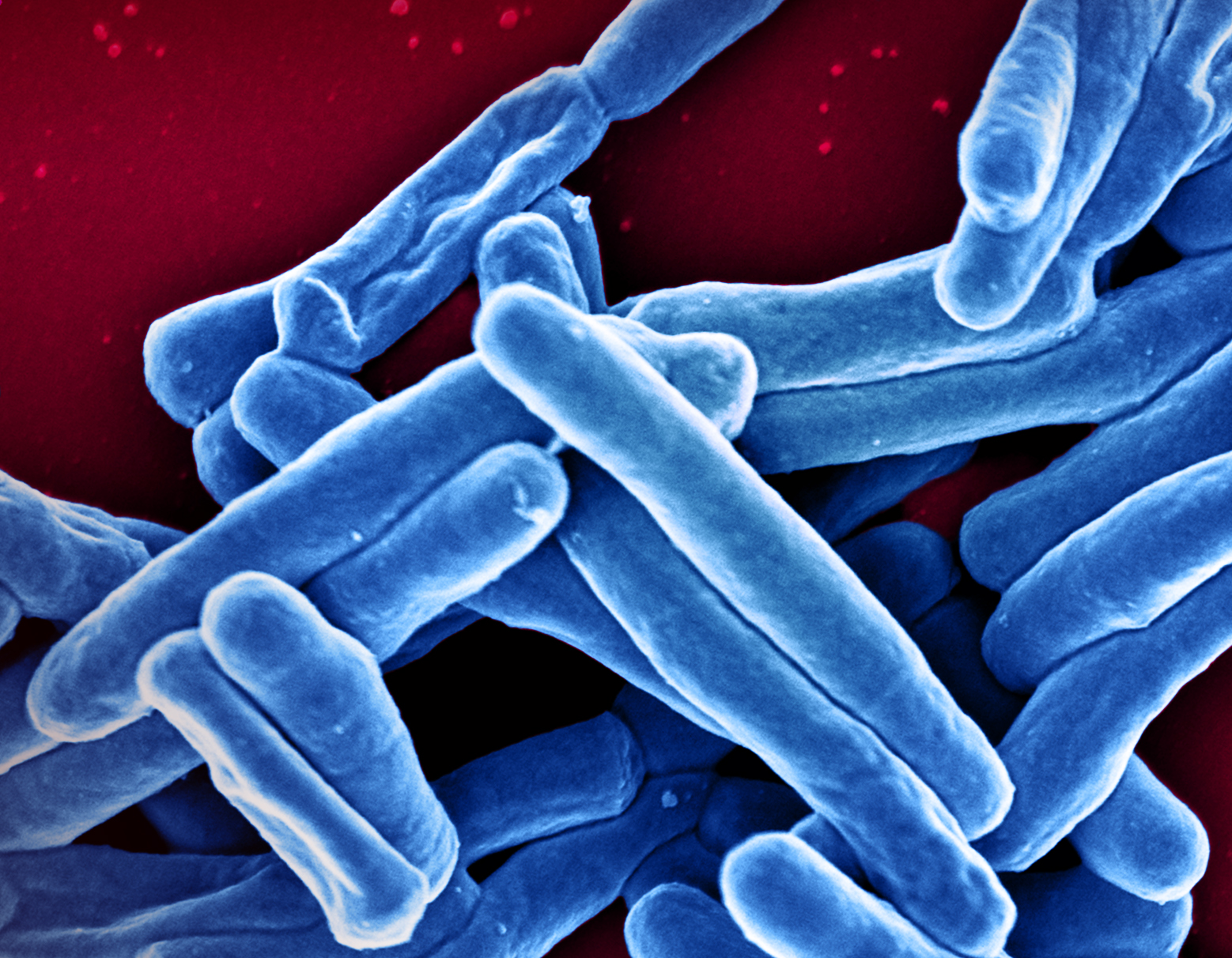 Scanning electron micrograph of oblong Mycobacterium tuberculosis particles colorized blue on red background.