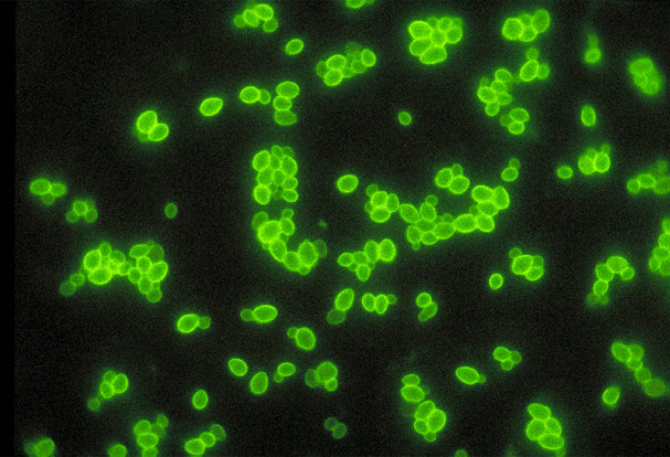 Fluorescent antibody stain revealing budding yeast cells of Candida albicans fungal organisms.