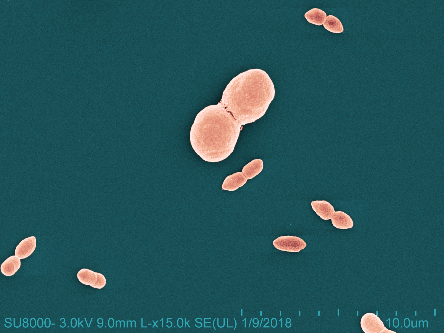 Light pink coccobacillus (short oval) shaped bacteria of various sizes on a dark teal background. Each bacterium consists of two conjoined short ovals.