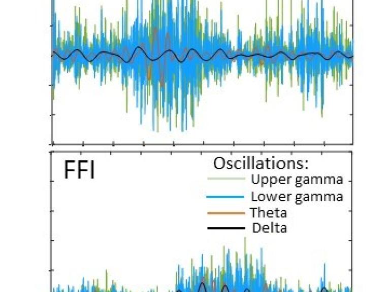 This image shows differences in brain waves, illustrating brain cell dysfunction in organoid models of fatal familial insomnia compared to controls.