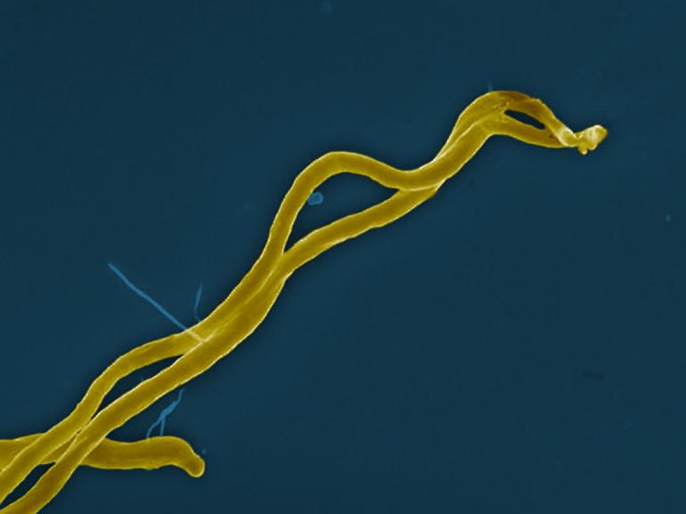 Borrelia burgdorferi bacteria, which can cause Lyme disease through the bite of an infected tick, is shown in gold color.