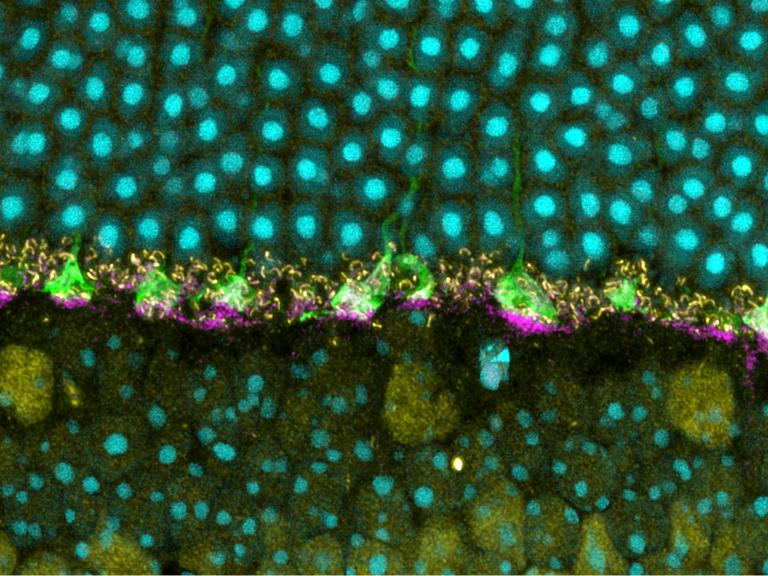 This image shows the outer layer of a mouse retina with normal prion protein visible at the base of photoreceptor terminals, called cone pedicles, which relay information about detected light to other retinal nerve cells and carry information to the brain to construct images.