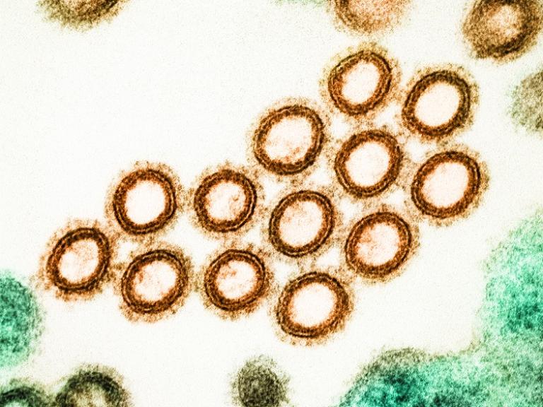 Image of influenza virus particles