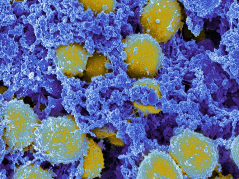 photo of Staphylococcus aureus