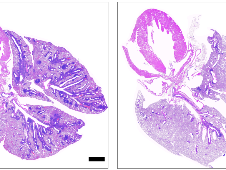 Two pink- and purple-speckled, lobe-shaped lung cross-sections in black-bordered boxes with white backgrounds, the left one with several dark purple regions in the cross-section.