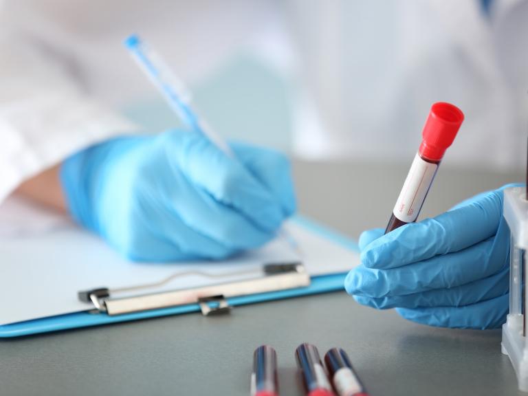 Scientist's gloved hands are visible writing note on a clipboard while holding test tube of blood