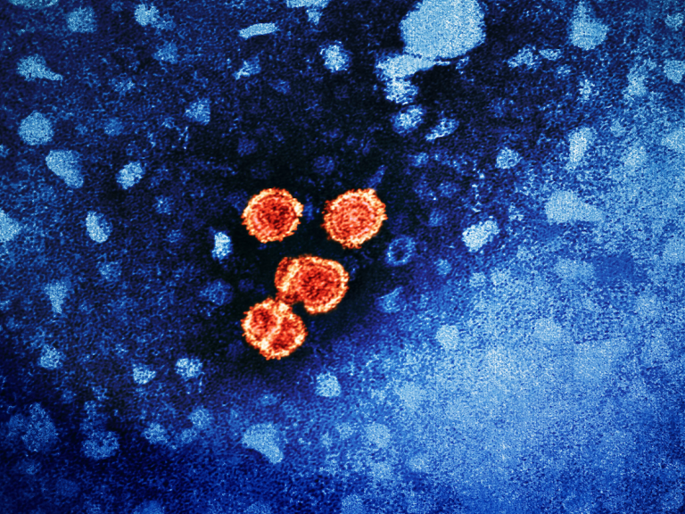 Image of Hepatitis B virus particles