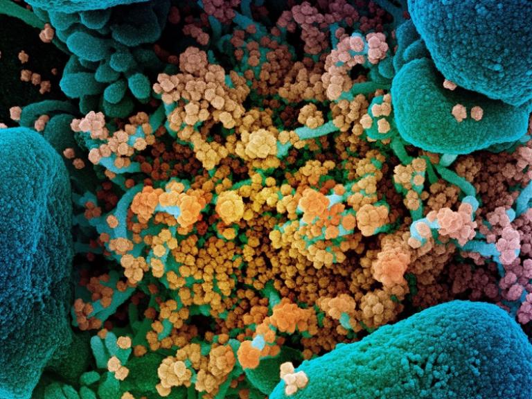 Scanning electron micrograph of a cell infected with SARS-CoV-2