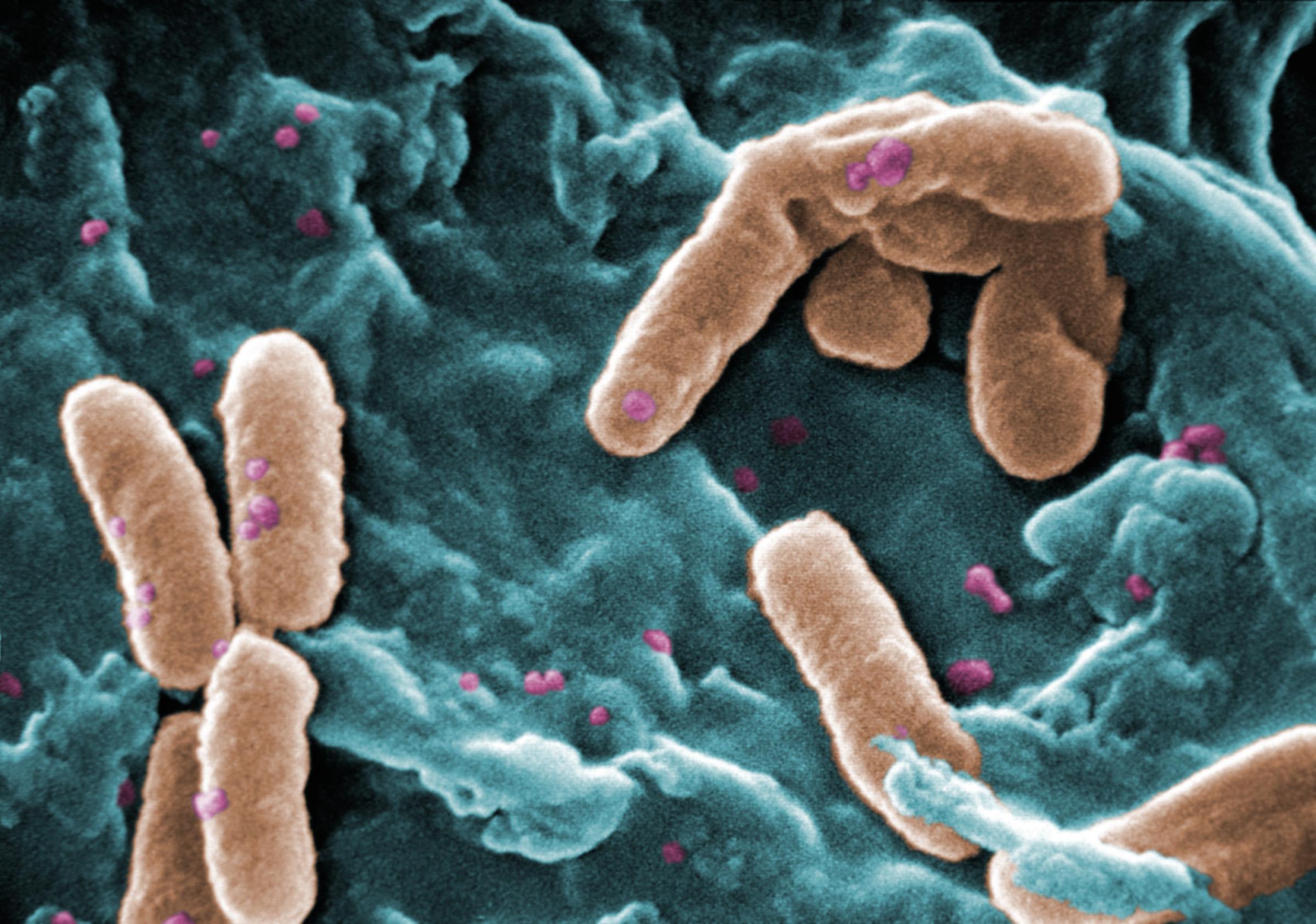 A digitally-colorized scanning electron microscopic image shows a number of rod-shaped Pseudomonas aeruginosa bacteria (colored pink).