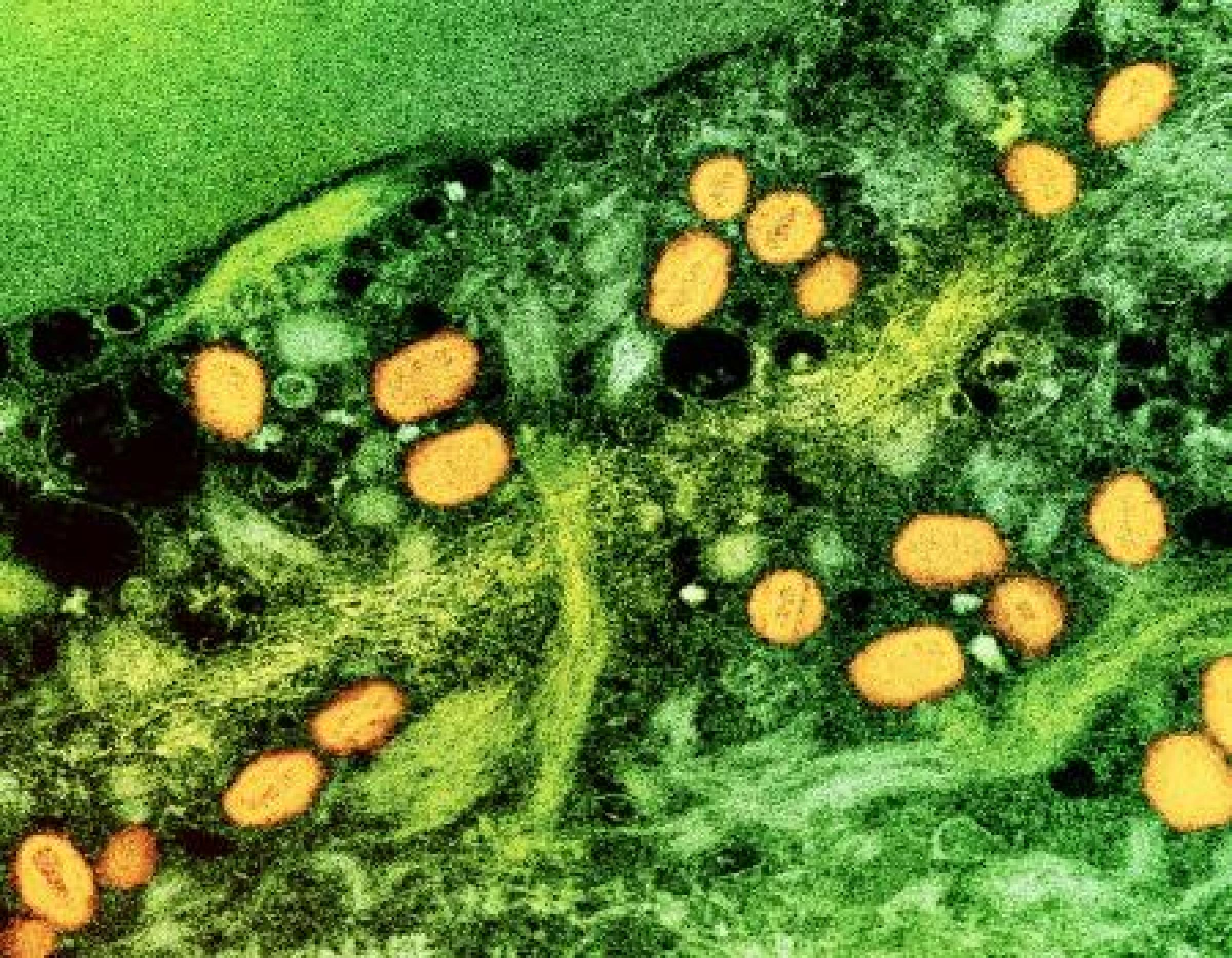 colorized green background tissue with yellow circles denoting the virus