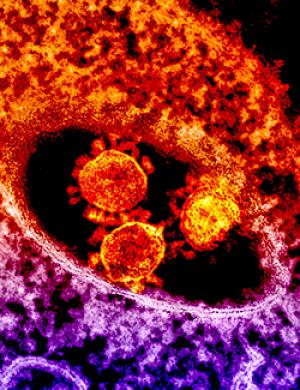 Colorized transmission electron micrograph showing particles of the Middle East Respiratory Syndrome Coronavirus that emerged in 2012.