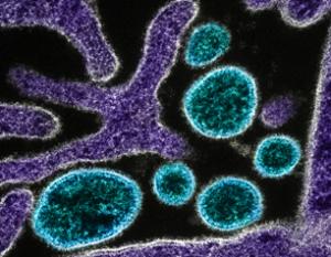 Nipah particles seen under microscope