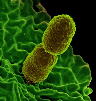 Colorized scanning electron micrograph showing carbapenem-resistant Klebsiella pneumoniae interacting with a human neutrophil