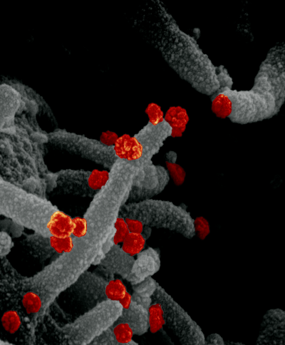 This scanning electron microscope image shows SARS-CoV-2 (round red particles) emerging from the surface of a cell cultured in the lab. 