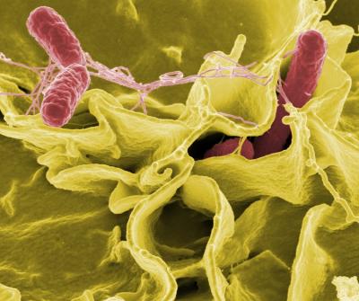 Salmonella bacteria (pink), a common cause of foodborne disease, invade a human epithelial cell.