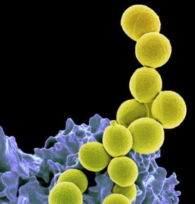 Methicillin-resistant Staphylococcus aureus bacteria (yellow) being ingested by neutrophil (purplish blue). 