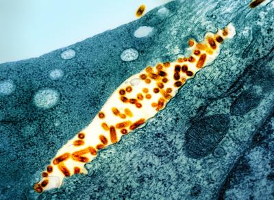 This transmission electron micrograph shows vesicular stomatitis virus particles colored orange budding from infected cells colored teal.