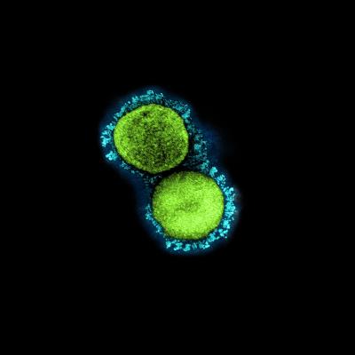 This transmission electron micrograph shows SARS-CoV-2 virus particles isolated from a patient sample and cultivated in cell culture. 