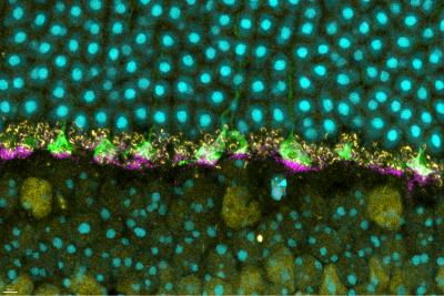 This image shows the outer layer of a mouse retina with normal prion protein visible at the base of photoreceptor terminals, called cone pedicles, which relay information about detected light to other retinal nerve cells and carry information to the brain to construct images.