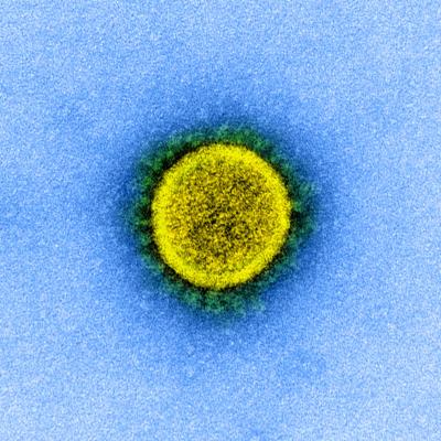 A transmission electron micrograph of a circular SARS-CoV-2 virus particle, colored yellow in this image