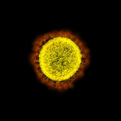 A transmission electron micrograph showing particles of the SARS-CoV-2 virus