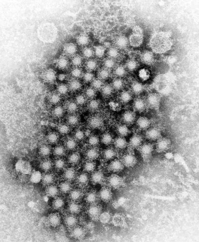  A cluster of circular hepatitis virus particles, as captured by a transmission electron microscope.