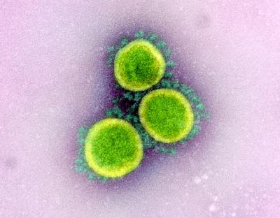 Transmission electron micrograph of SARS-CoV-2 virus particles