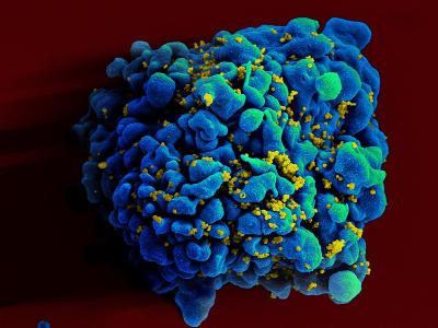 HIV infected H9 T cell