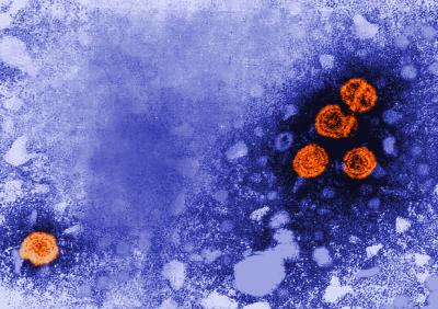 A transmission electron microscopic (TEM) image showing clusters of round hepatitis B viral particles, colored orange.