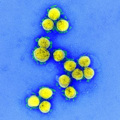 Transmission electron micrograph of SARS-CoV-2 virus particles