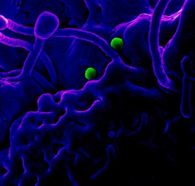 MERS virus particles on camel epithelial cells