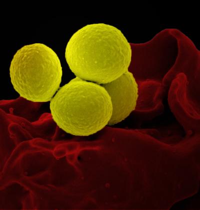 Scanning electron micrograph of a human neutrophil ingesting MRSA (yellow). 