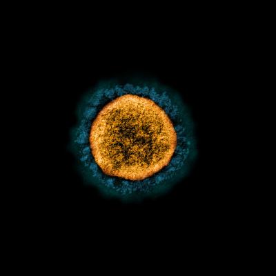 Transmission electron micrograph of a SARS-CoV-2 virus particle (UK B.1.1.7 variant)